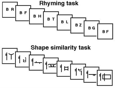 Anatomical Modularity of Verbal Working Memory? Functional Anatomical Evidence from a Famous Patient with Short-Term Memory Deficits